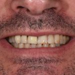 Cosmetic Dentistry Patient 3 Before | The Crown Dental Group