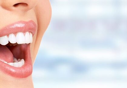Teeth Whitening with Crown Dental Group