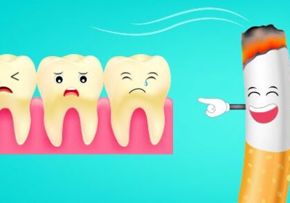 What Smoking Really Does to Your Teeth