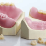 Digital Dentures