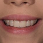 Cosmetic Dentistry Gallery