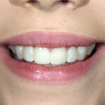 Cosmetic Dentistry Gallery