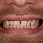 Before Cosmetic Dentistry