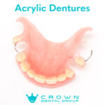 Types of Dentures (LP)