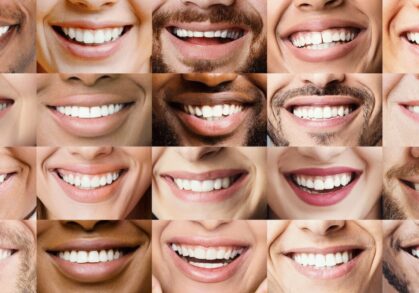 New Trends in Cosmetic Dentistry: Enhancing Your Smile