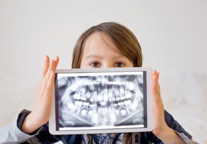 Paediatric Dental X-Rays: Balancing Necessity, Safety, and Guidelines