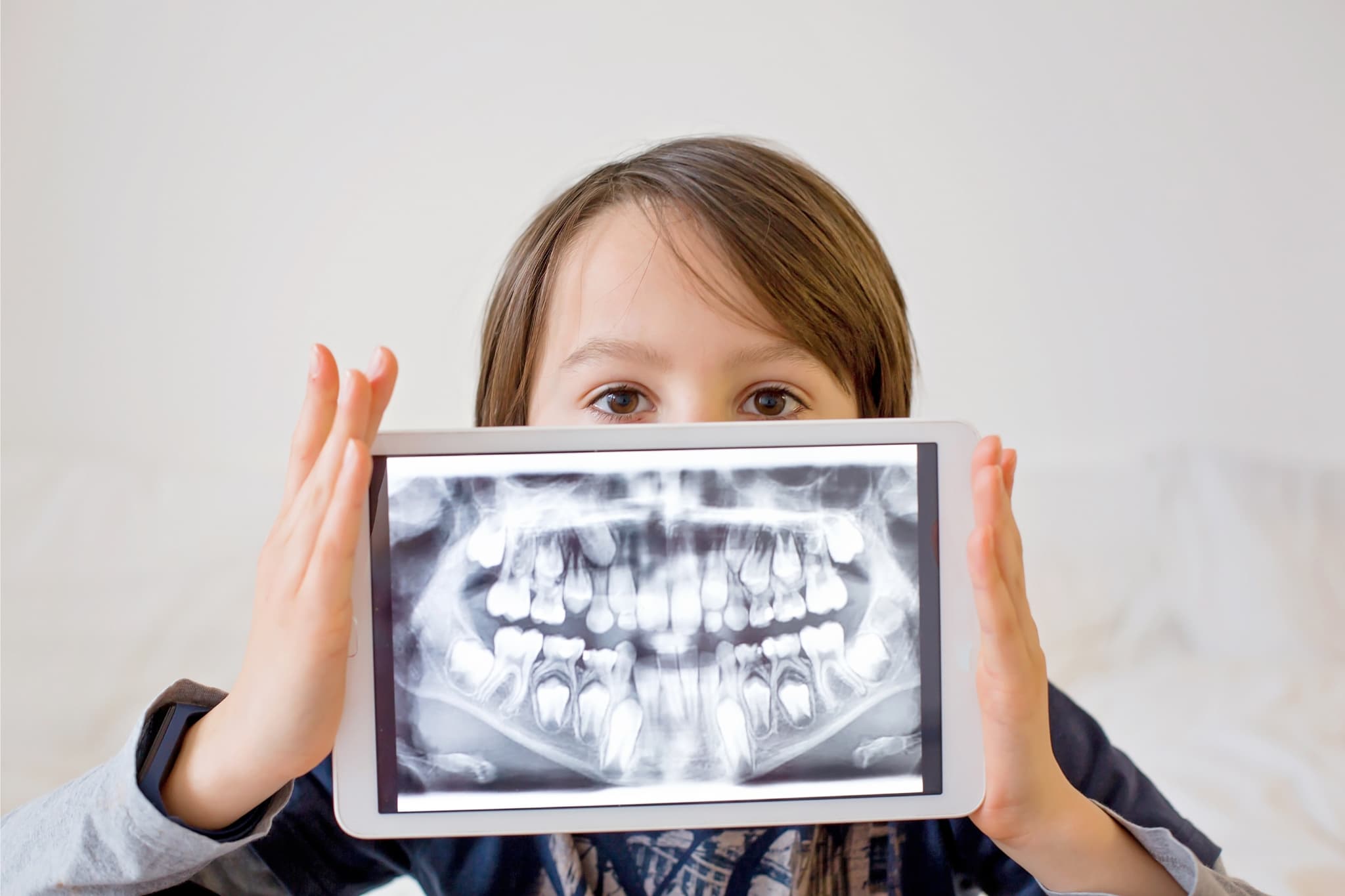 Paediatric Dental X-Rays: Balancing Necessity, Safety, and Guidelines