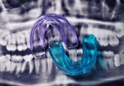 Store Bought vs Custom Mouthguards: Which One is Right for You?