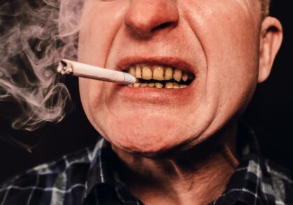 The Hidden Dangers of Smoking on Oral Health