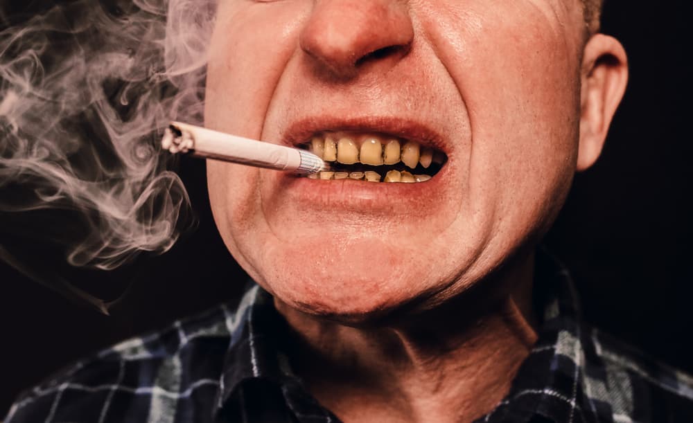 Smoking on Oral Health