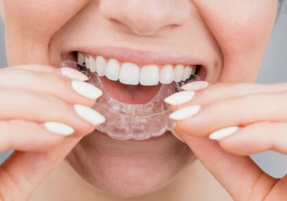 How a Properly Fitted Mouthguard Can Protect More Than Just Your Teeth