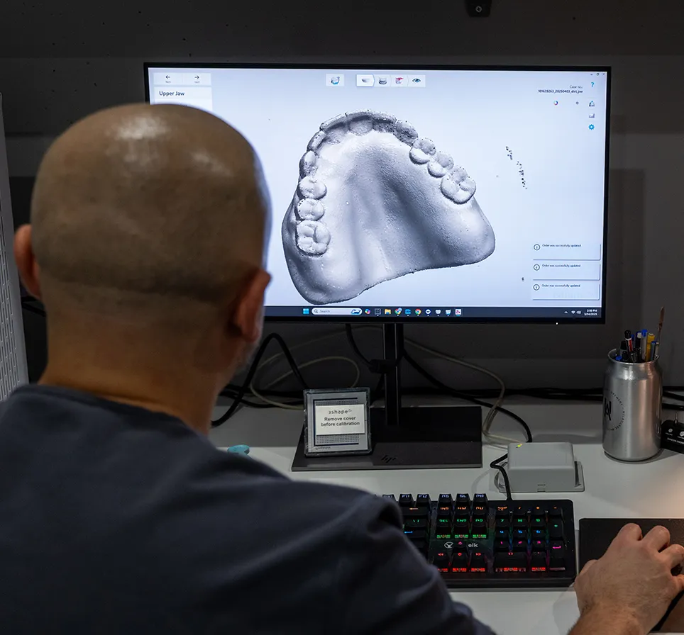 A person with a shaved head views a 3D dental model on a computer screen. The image shows an upper jaw scan, indicating a focus on dental technology.