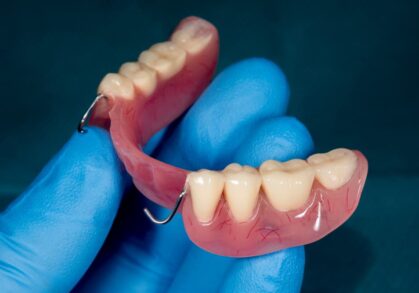 Acrylic Partial Dentures: A Comfortable and Affordable Solution