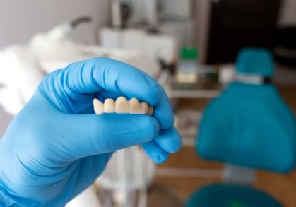 How Full Dental Bridges Improve Speech and Chewing Ability