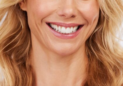 Porcelain Veneers in Melbourne’s South-East: What Crown Dental Group Patients Want to Know