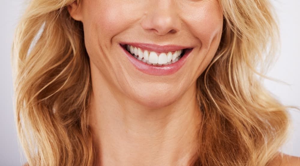 porcelain veneers Ferntree Gully