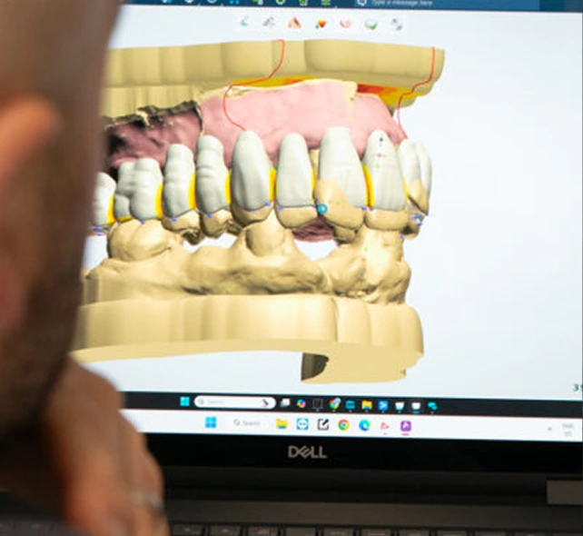 A person views a digital 3D model of a human jaw on a laptop, showing detailed teeth and gums