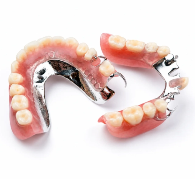 A dental model with partial dentures on a white base, showcasing metal clasps and pink gum-colored acrylic, representing lower jaw teeth replacement.